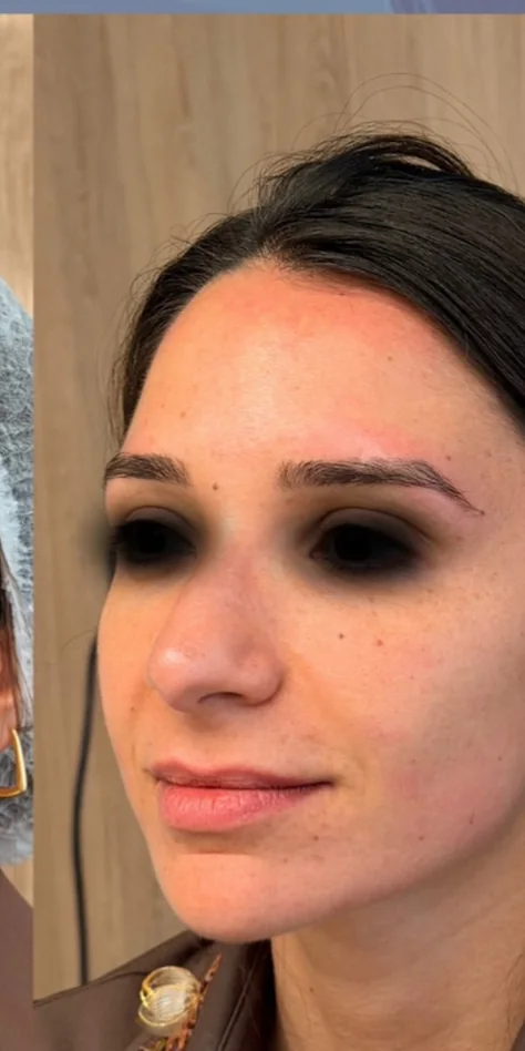 Depois: rosto de três quartos, com os olhos cobertos