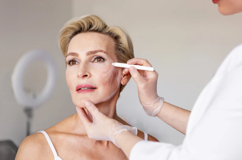 Lifting facial não cirúrgico